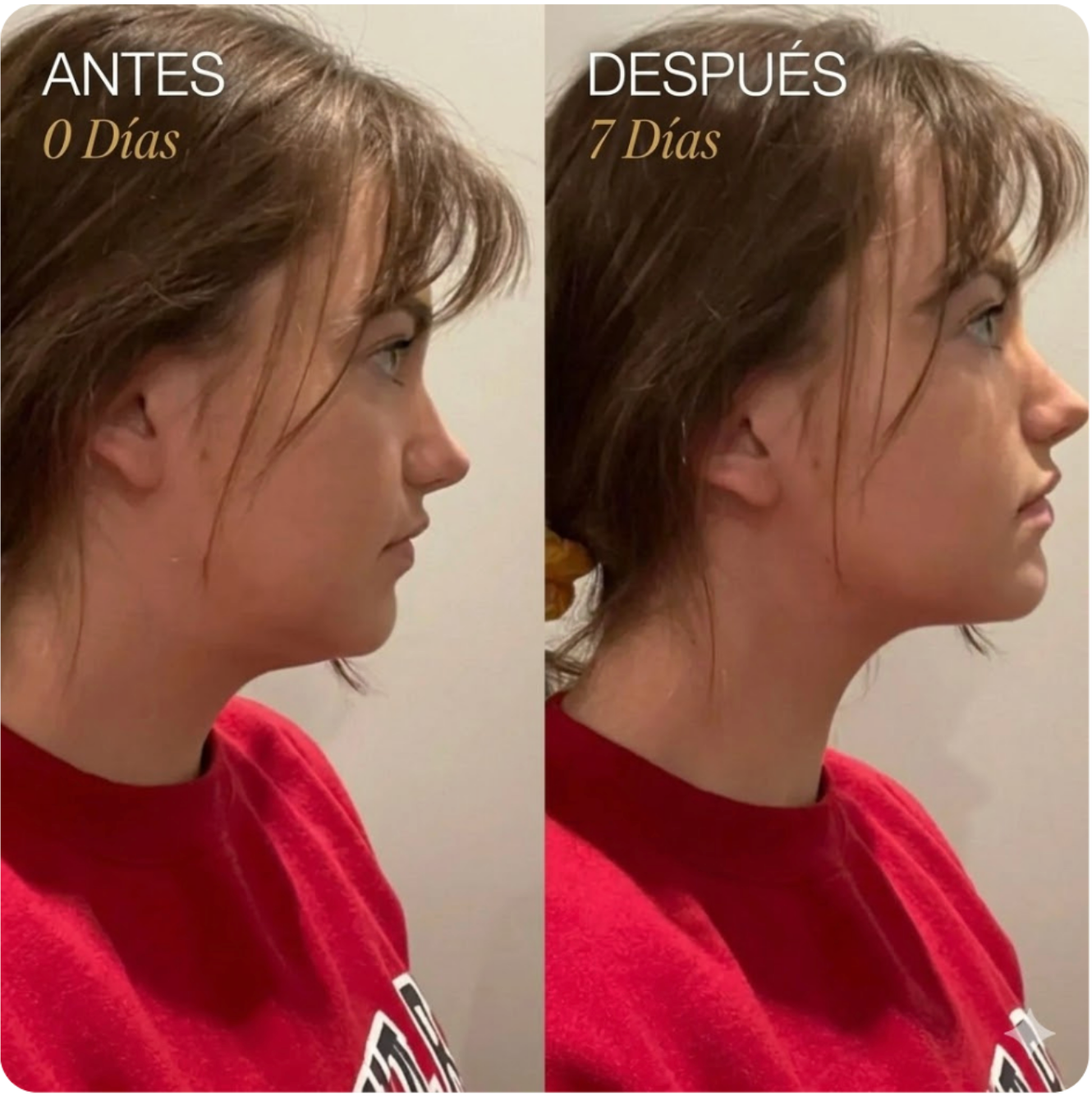 Cepillo de drenaje linfático facial